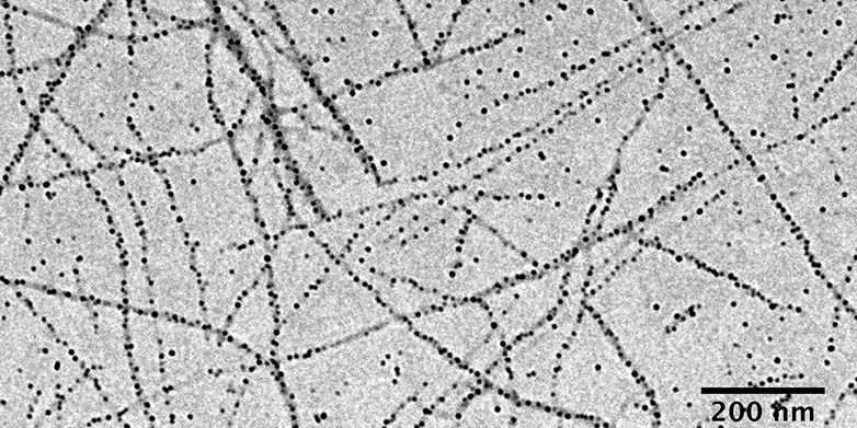 Essbare Molkeprotein-Nanofasern binden auf ihrer Oberfläche Eisen-Nanopartikel (schwarze Punkte). Dieses Präparat könnte Eisenmangel auf effiziente und günstige Weise bekämpfen. (TEM-Bild: ETH Zürich/Yi Shen)
