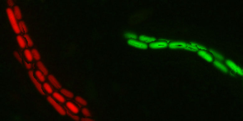 Two clumped clones (red and green) of salmonella are held together by IgA antibodies. (Image: Emma Slack / ScopeM, ETH Zurich)