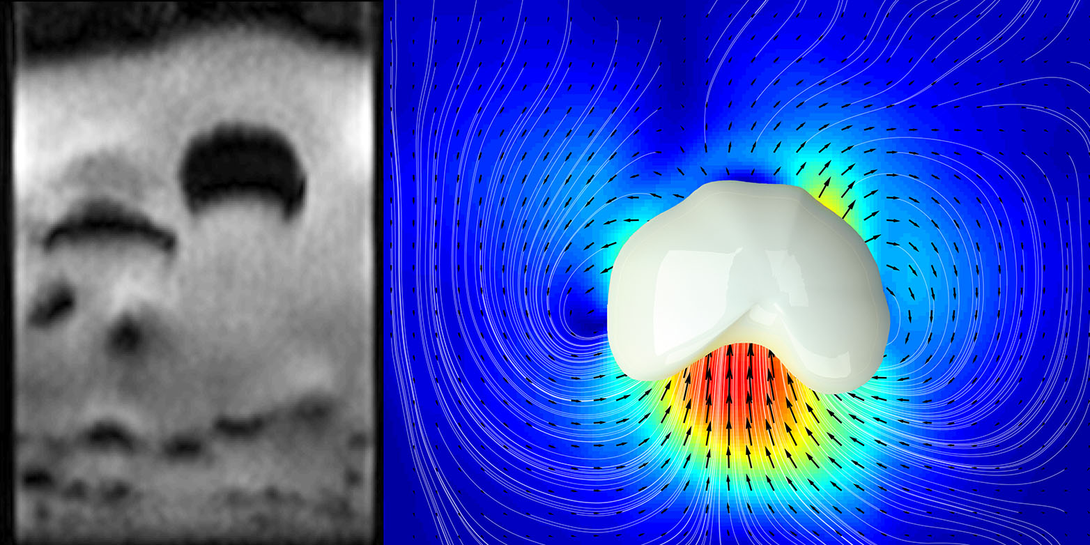 Enlarged view: Researchers at ETH have used magnetic resonance imaging to make bubbles visible inside granular media through which a gas flows (left). The velocities of the individual particles (arrows in the right-hand image) could also be measured in this way.(Graphics: Alexander Penn / ETH Zurich)