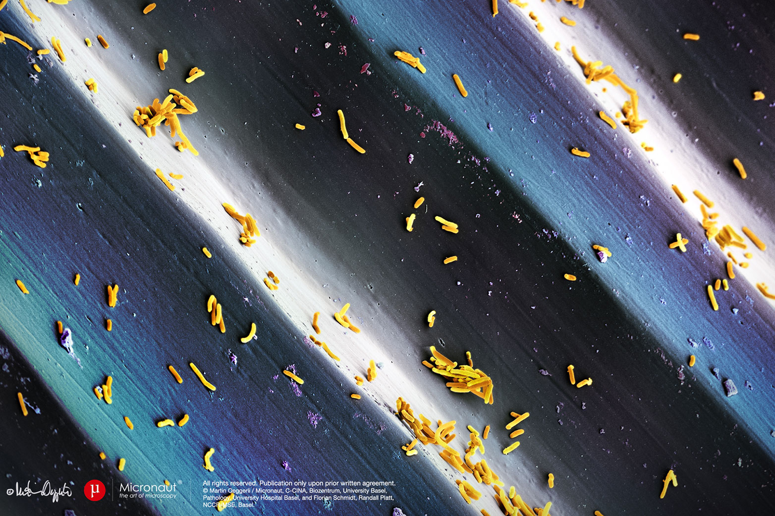 Enlarged view: E.coli-Bakterien auf Vinyl-Schallplatt