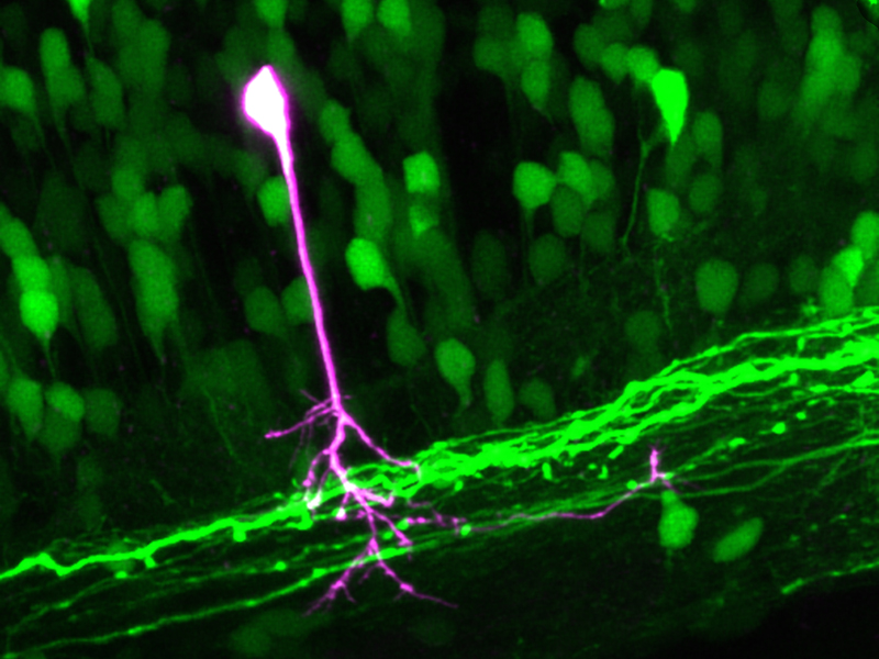 Vergrösserte Ansicht: Motorische Nervenzellen im Rückenmark einer lebenden Zebrafisch-Larve