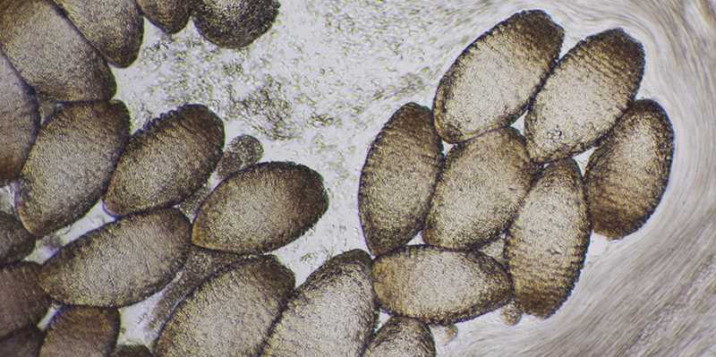 Vergrösserte Ansicht: Das Sekret des Schleimaals unter dem Mikroskop: In den kokonartigen Zellen ist der Proteinfaden auf spezielle Weise aufgewickelt. (Bild: ETH Zürich/Simon Kuster)