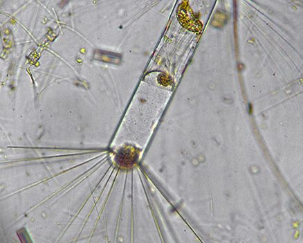 Vergrösserte Ansicht: Phytoplankton aus dem Südlichen Ozean