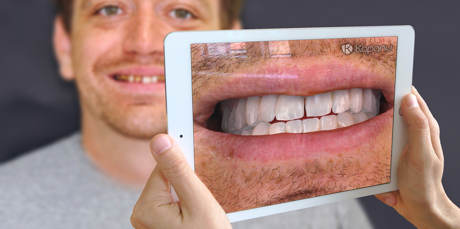 Vergrösserte Ansicht: Danke der Kapanu-Software können Patienten und Zahnärzte vor dem Eingriff das angestrebte Ergebnis von Zahnkorrekturen sehen. (Bild: Kapanu)