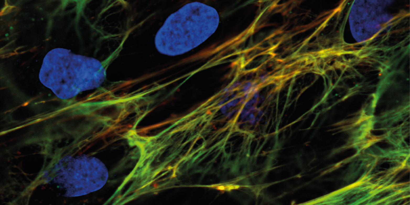 Fluorescent-labeled fibronectin is seen on the surface of a single cell.