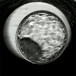 Schon frühe Embryonen - hier eine Blastozyste - zeigen die gleichen Veränderungen am Erbgut wie die Muttersauen. (Bild: ETH Zürich)