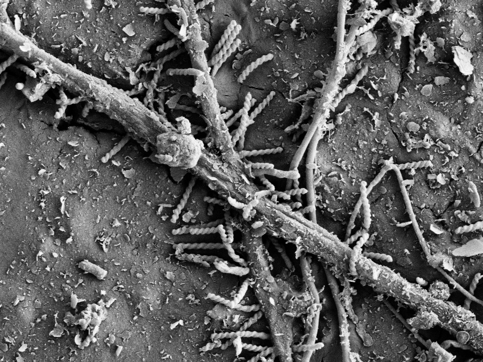 Vergrösserte Ansicht: Bakterien gesellen sich für den Bioabbau zu den Pilzfäden. (Elektronenmikroskopie-Bilder: ETH Zürich / Gruppe Umweltchemie)