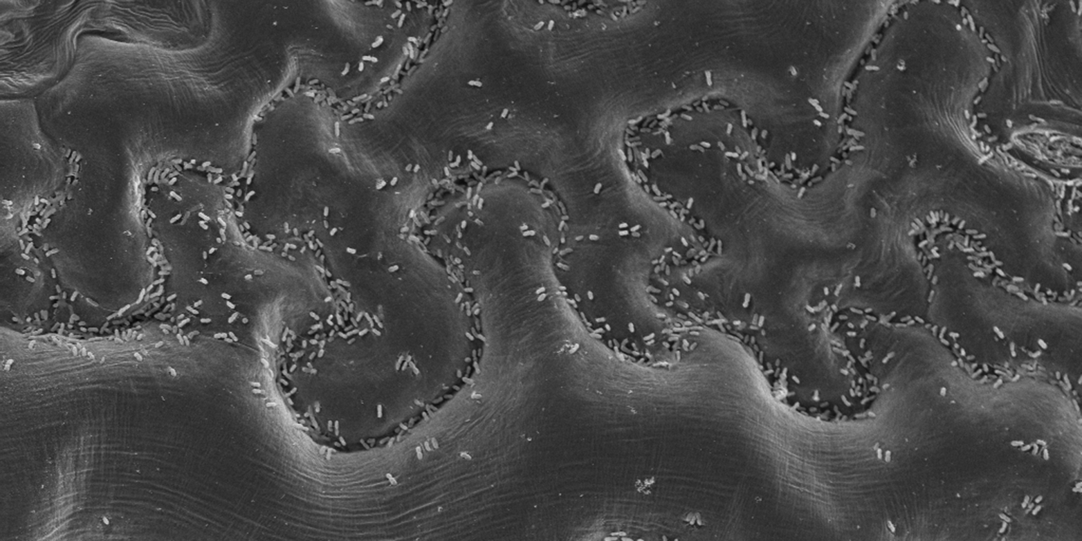 Vergrösserte Ansicht: Auf Blattoberflächen lebt eine reichhaltige Mikrobengemeinschaft, die zahlreiche noch unerforschte Naturstoffe produziert. (Bild: Gerd Innerebner / Roger Wepf, ScopeM)