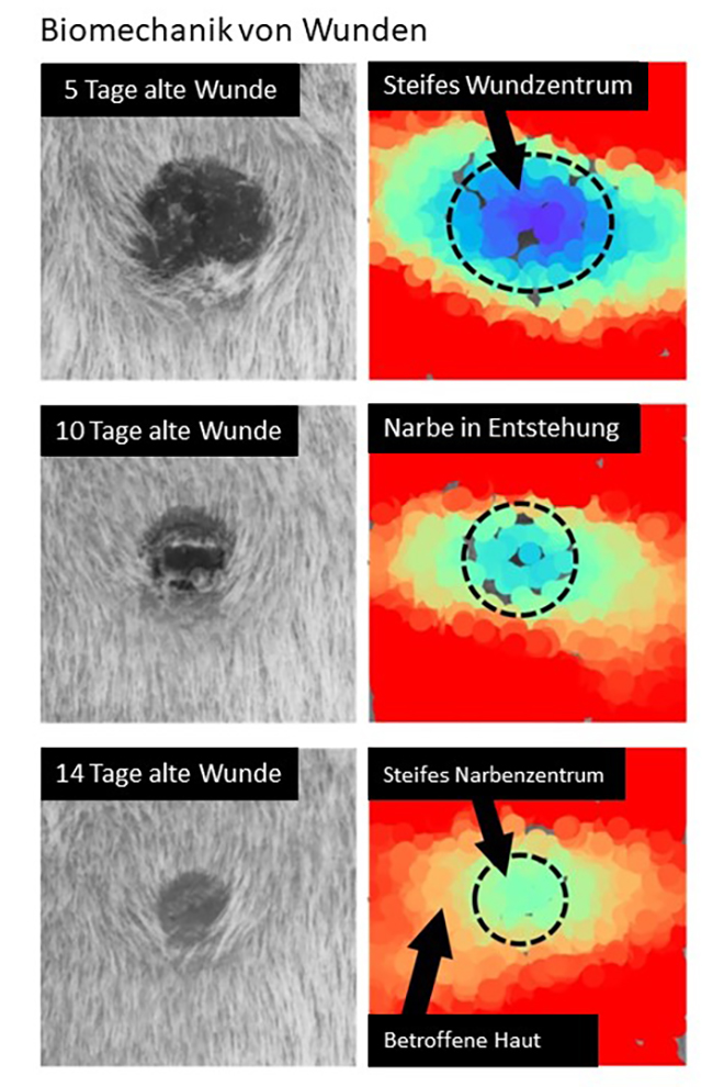 Vergrösserte Ansicht: Wundmorphologie (linke Spalte) und Deformierbarkeit der Narbe in vivo. (nach Wietecha et al., Nat. Comm., 2020)