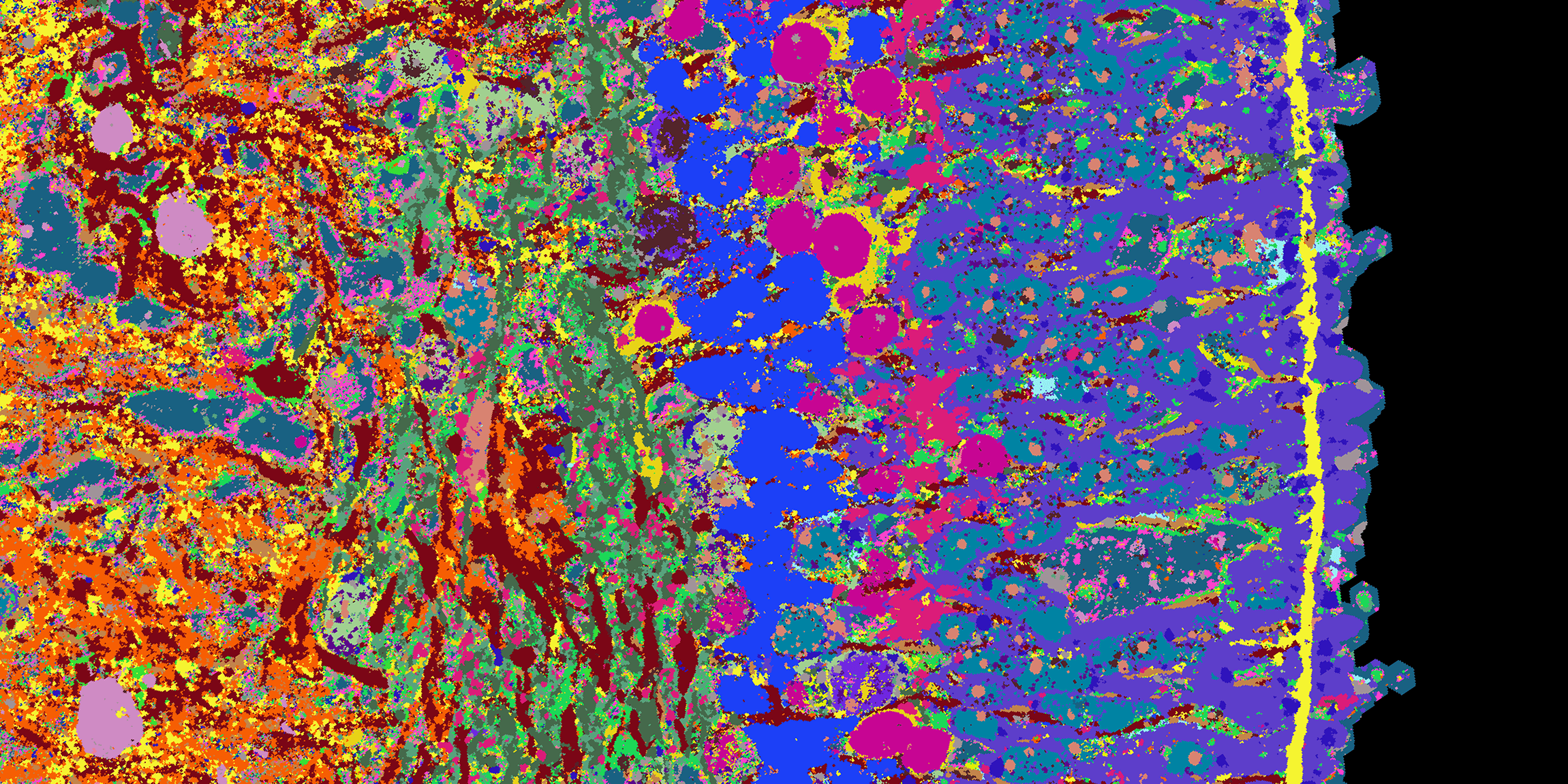 Querschnitt Netzhaut-Orgnoid: Unterschiedliche Gewebestrukturen durch unterschiedlichen Farben erkennbar