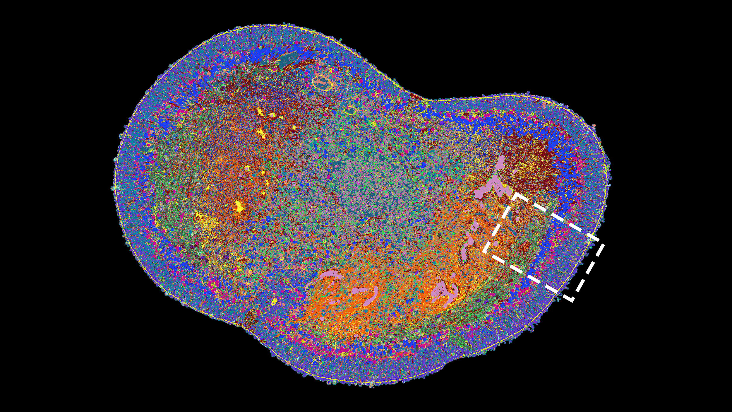 Vergrösserte Ansicht: Querschnitt eines ganzen Netzhaut-Organoids. Unterschiedliche Proteine sind mit unterschiedlichen Farben sichtbar gemacht.