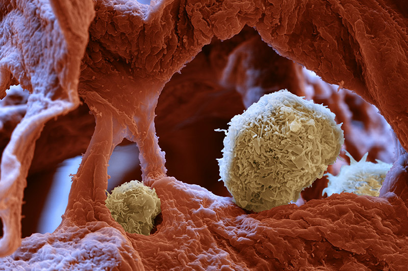 Enlarged view: Alveolar macrophages (Copyright: Eye of Science)