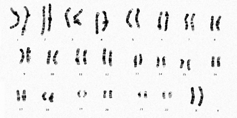 Enlarged view: Chromosome set (Image: Serpil Borlu / istock)
