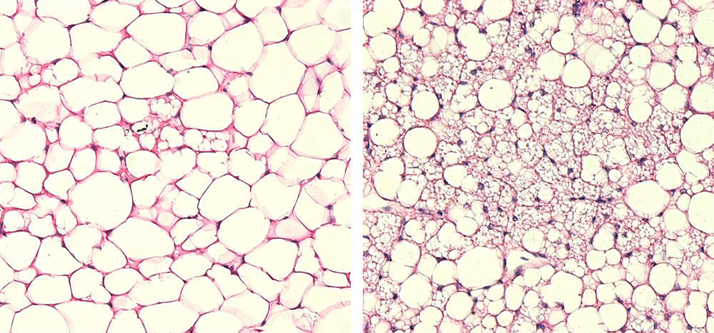 Microscope images of large (left) and small (right) fat cells