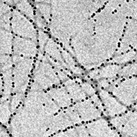 Edible whey protein nanofibrils carrying iron nanoparticles (black dots) could eliminate iron deficiency in an efficient and inexpensive way