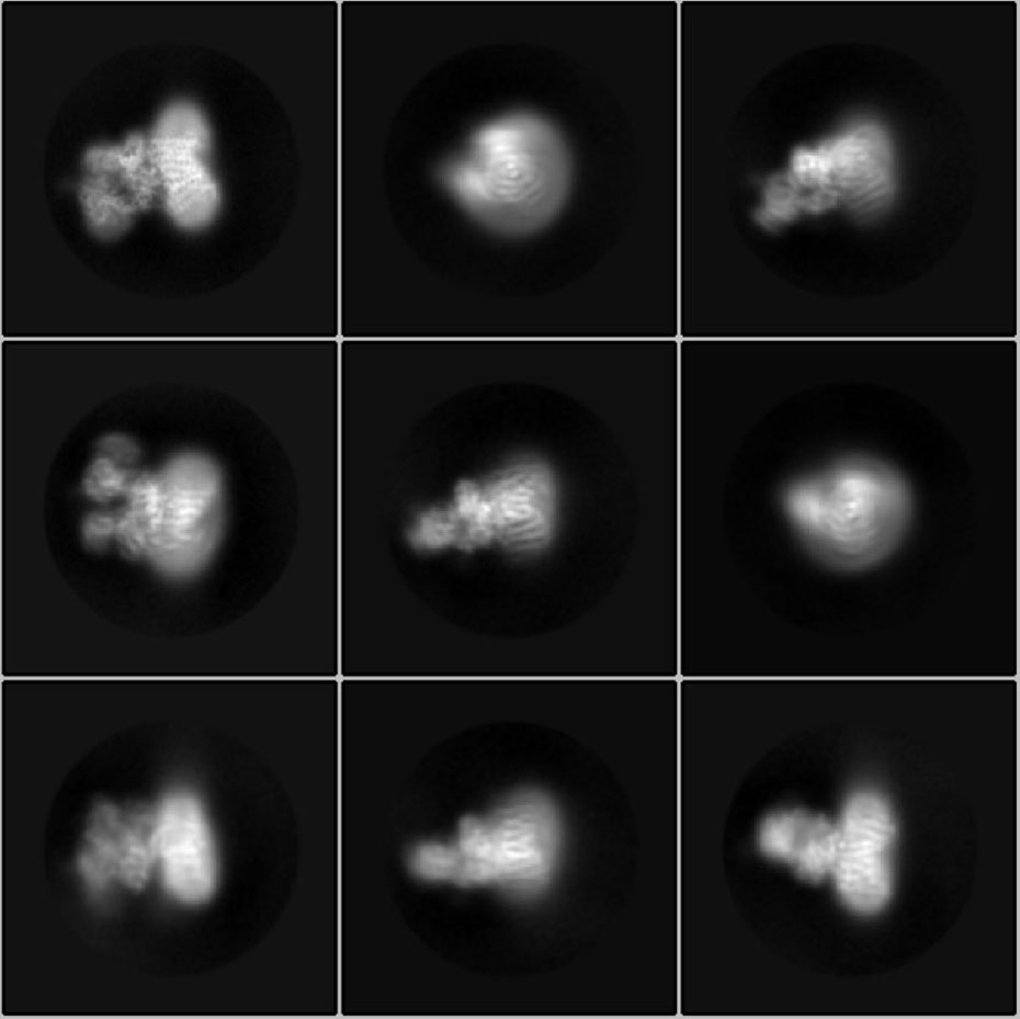 Enlarged view: Cryoelectron microscope images of the enzyme. (Images: Rebekka Wild / ETH Zurich)
