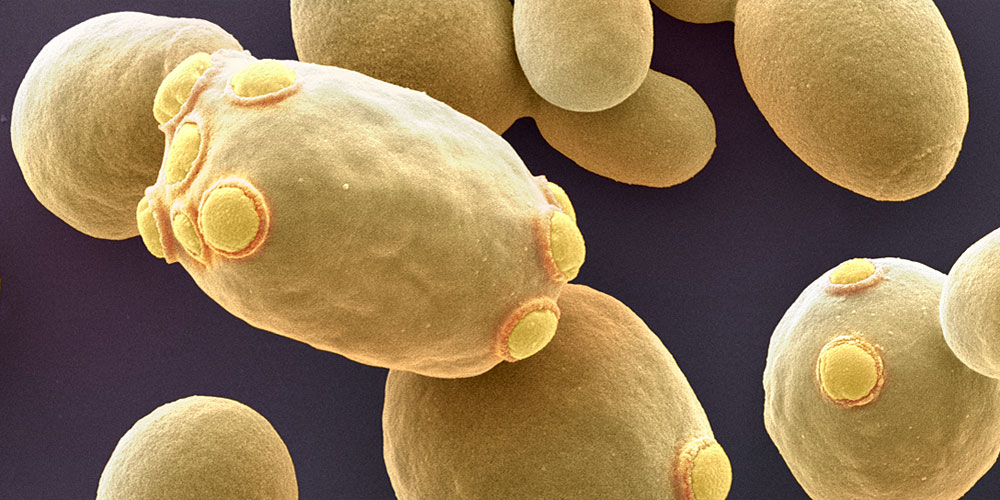 Enlarged view: During mitosis, yeast cells dispose of unwanted genetic material in the mother cell so that the daughter cells can build up a new population without potentially harmful foreign DNA. (Picture: Univ. Basel/SNI/Nano Imaging Lab)