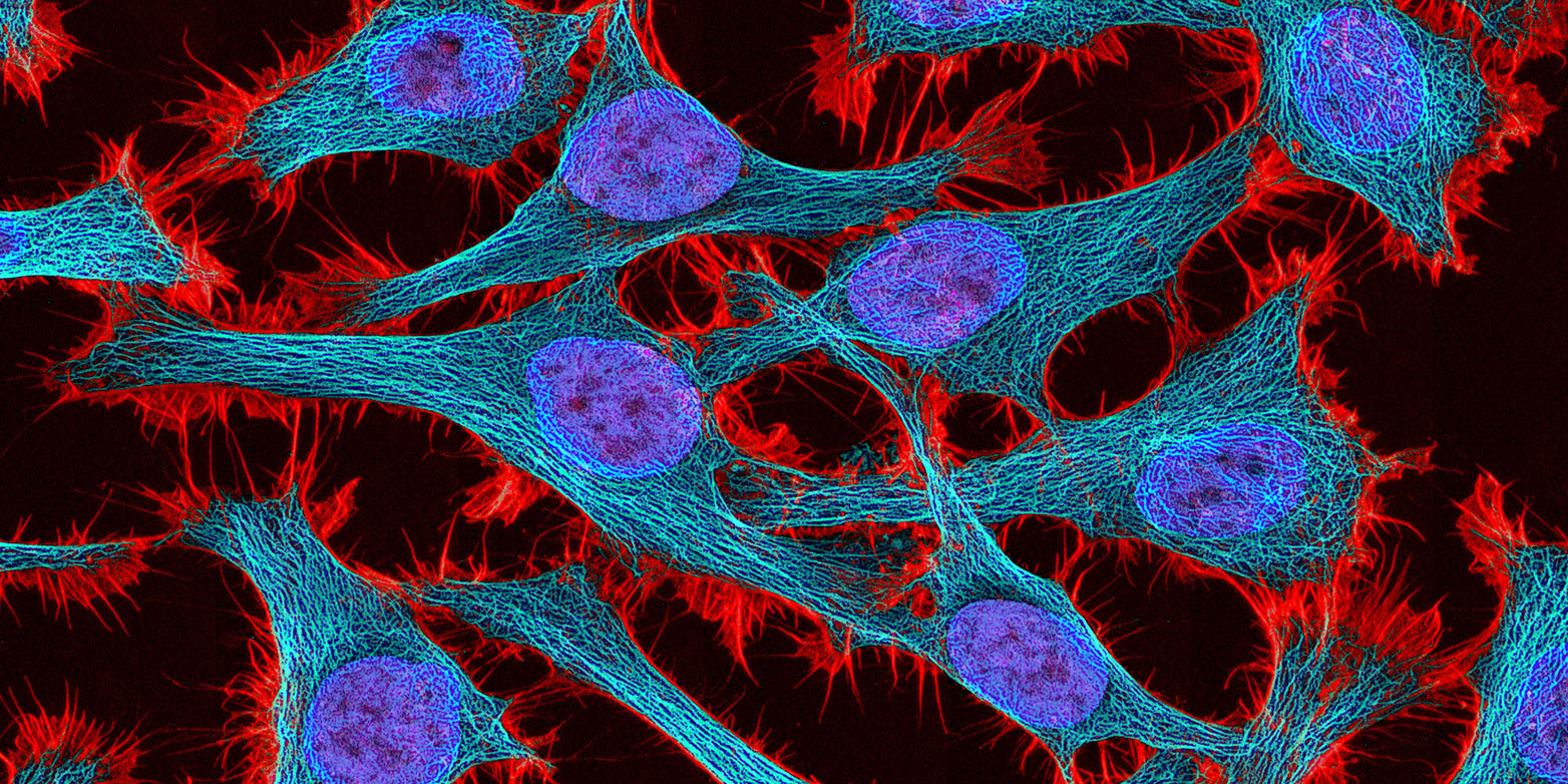 Multiphoton fluorescence image of HeLa cells stained with the actin binding toxin phalloidin (red), microtubules (cyan) and cell nuclei (blue). (Image: National Institutes of Health (NIH)