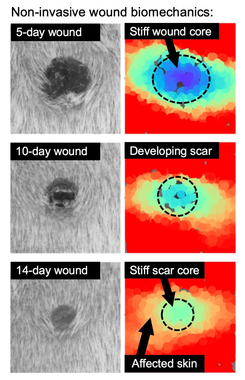 Enlarged view: Wound morphology (left column) and deformability of the scar in vivo. (according to Wietecha et al., Nat. Comm., 2020)