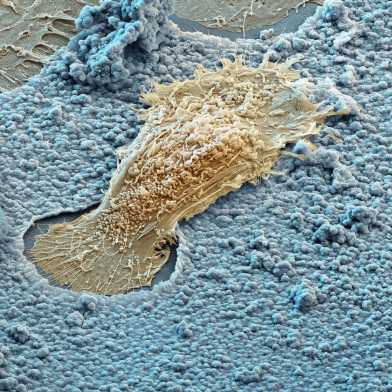 Scanning electron microscope image of an osteoclast. Picture: eye of science