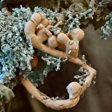 Microscopic image of microbes on humus
