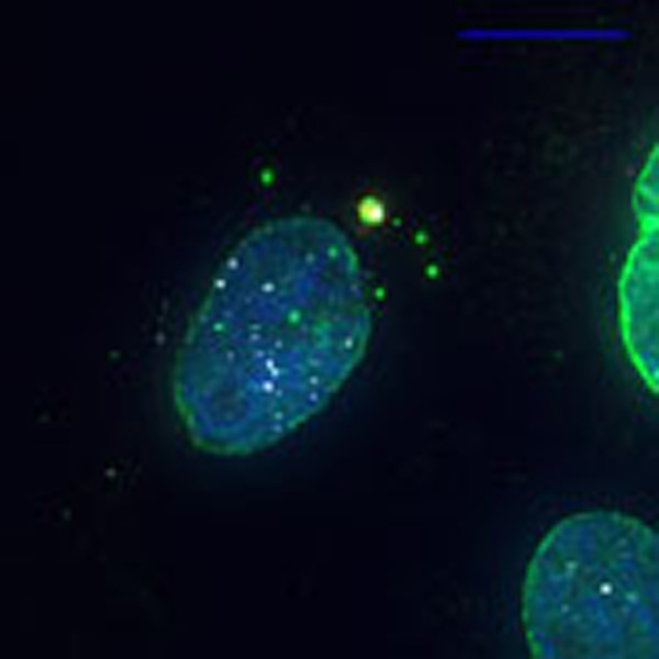 Microscope image, blue cell nucleus against black background. In the vicinity of the cell nucleus, the exclosome is visible in yellow-green.