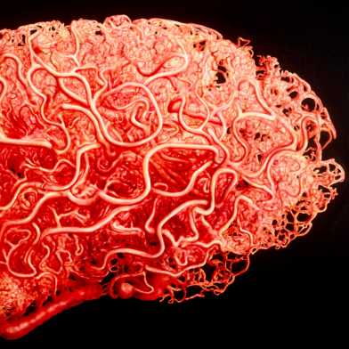 Brain simulated from blood vessels