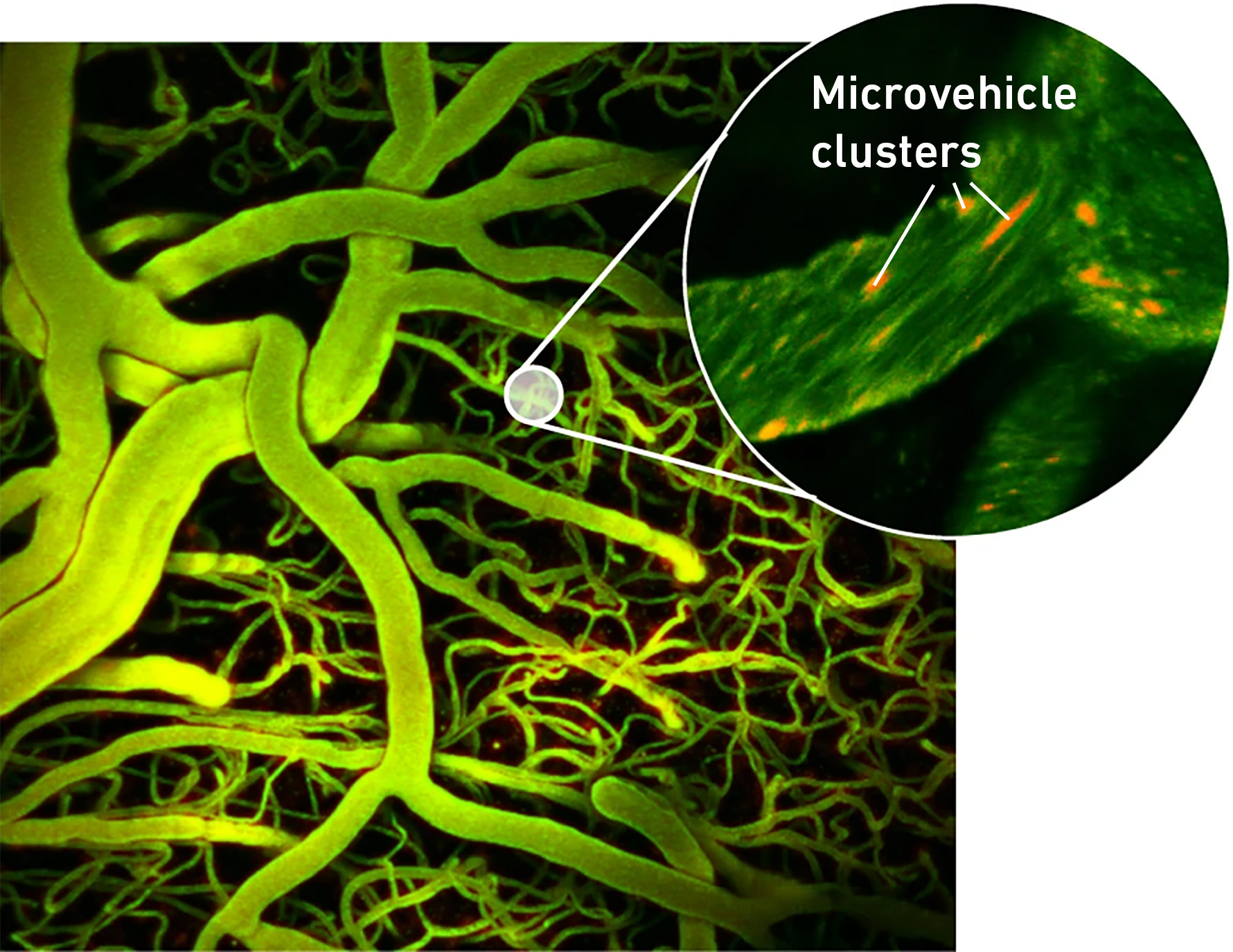 Enlarged view: Microscopy image showing the microvehicles.