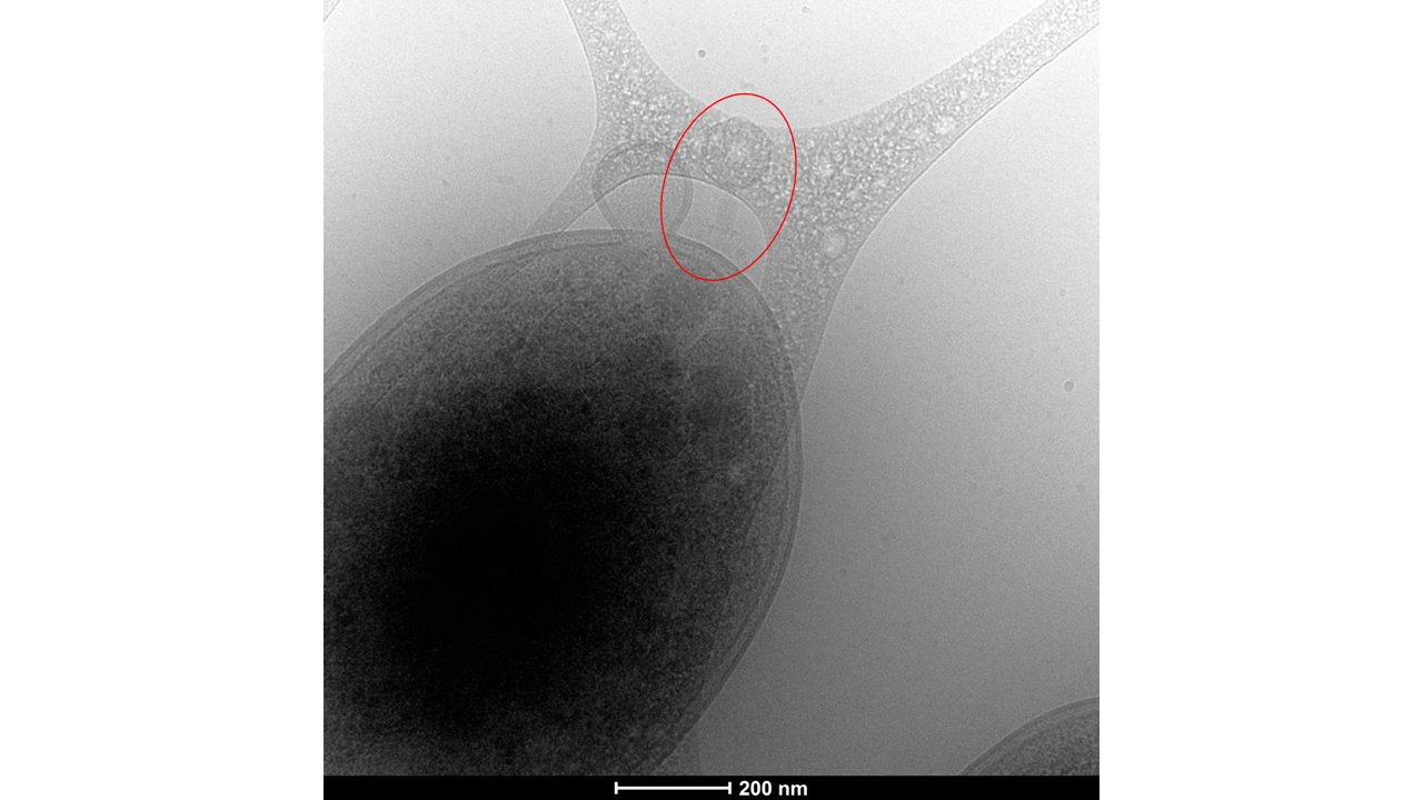 Microscope image of the effect of the phages
